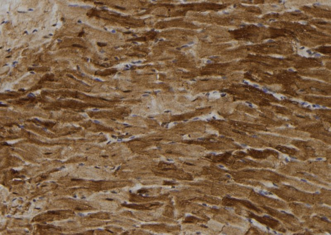 PFKFB3 Antibody in Immunohistochemistry (Paraffin) (IHC (P))