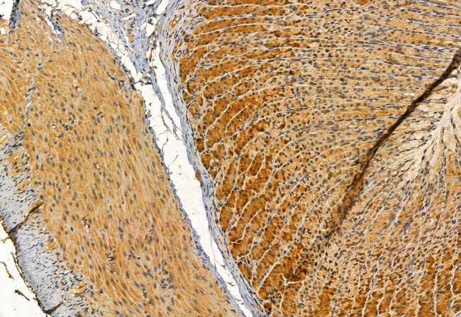 HIPPI Antibody in Immunohistochemistry (Paraffin) (IHC (P))