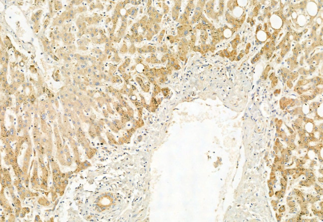 PPP1R15B Antibody in Immunohistochemistry (Paraffin) (IHC (P))