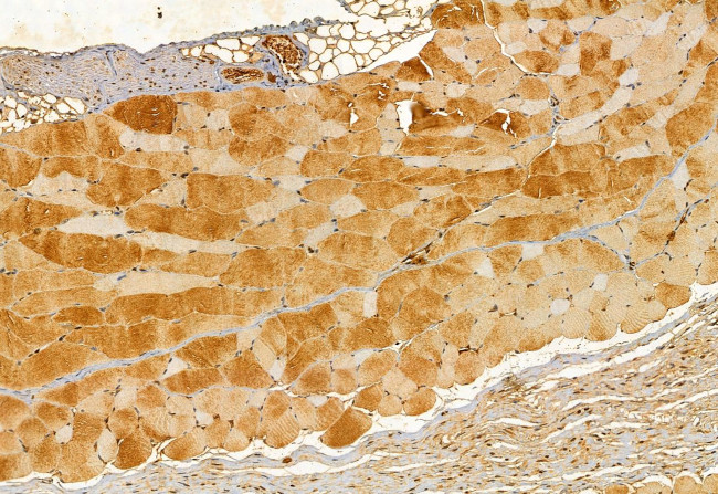 KIAA1199 Antibody in Immunohistochemistry (Paraffin) (IHC (P))