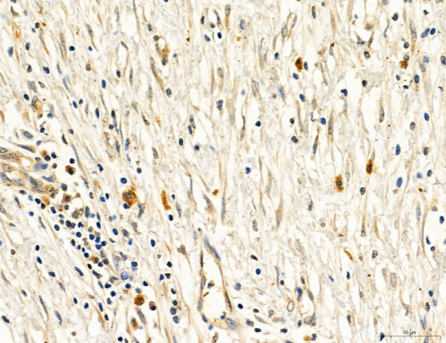 PBXIP1 Antibody in Immunohistochemistry (Paraffin) (IHC (P))