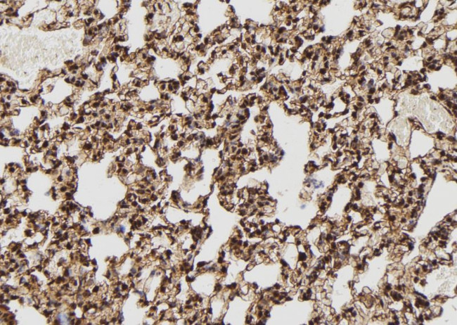 DSS1 Antibody in Immunohistochemistry (Paraffin) (IHC (P))