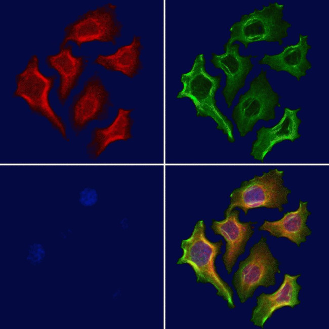STX11 Antibody in Immunocytochemistry (ICC/IF)