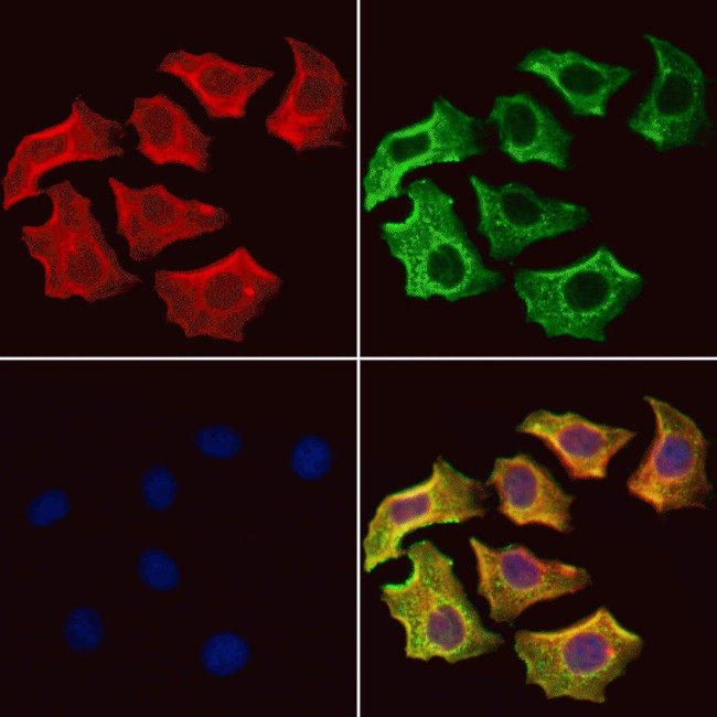 UQCRB Antibody in Immunocytochemistry (ICC/IF)