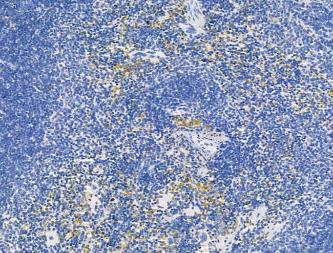 PNAS4 Antibody in Immunohistochemistry (Paraffin) (IHC (P))