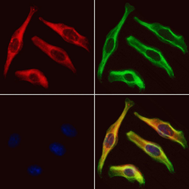 PRPH2 Antibody in Immunocytochemistry (ICC/IF)