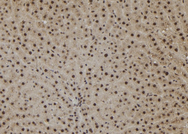 SHOC2 Antibody in Immunohistochemistry (Paraffin) (IHC (P))