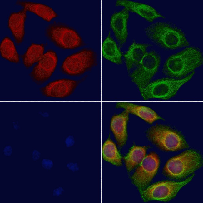BBS7 Antibody in Immunocytochemistry (ICC/IF)