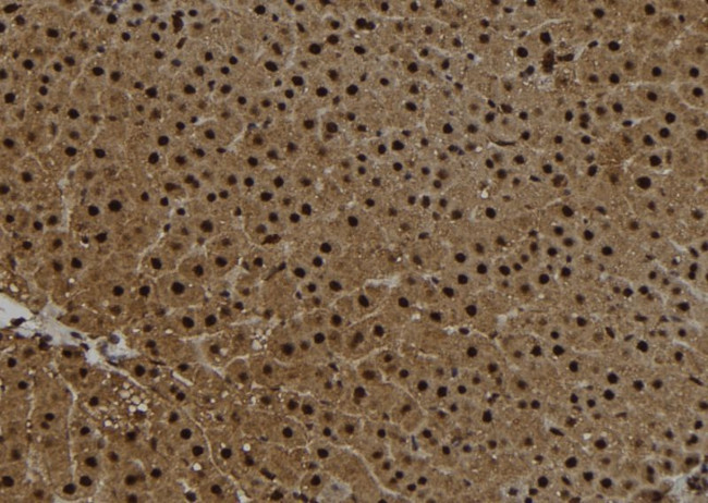 Centrin 2 Antibody in Immunohistochemistry (Paraffin) (IHC (P))