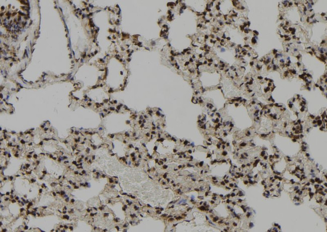 CEP164 Antibody in Immunohistochemistry (Paraffin) (IHC (P))
