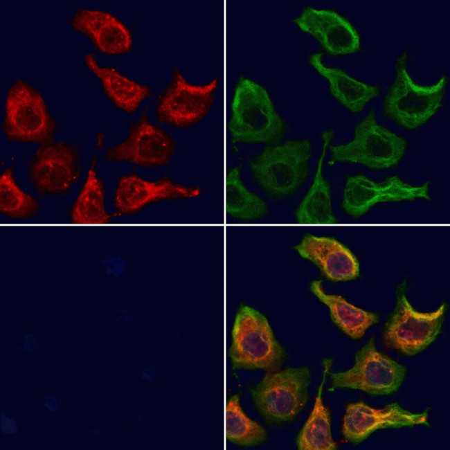 CHCHD3 Antibody in Immunocytochemistry (ICC/IF)