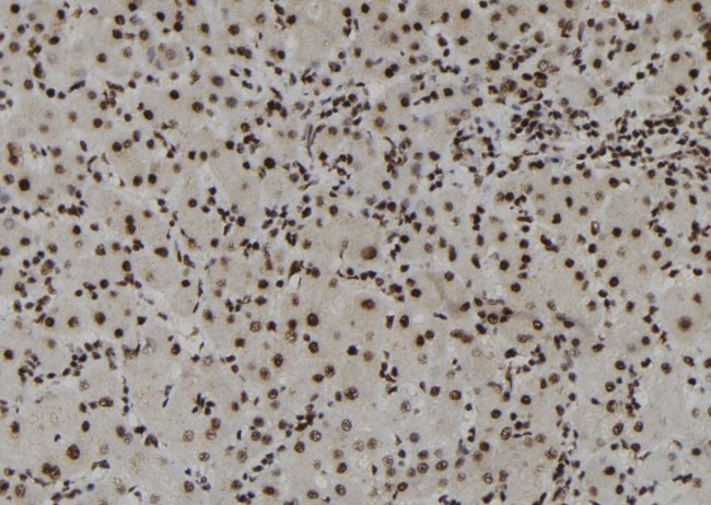 DHX38 Antibody in Immunohistochemistry (Paraffin) (IHC (P))
