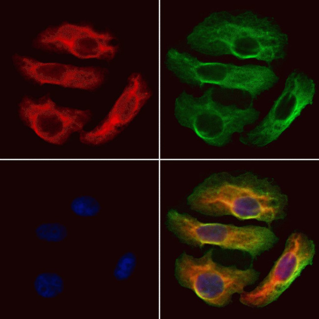HBE1 Antibody in Immunocytochemistry (ICC/IF)