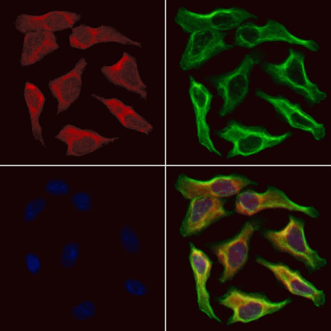 NDUFB11 Antibody in Immunocytochemistry (ICC/IF)