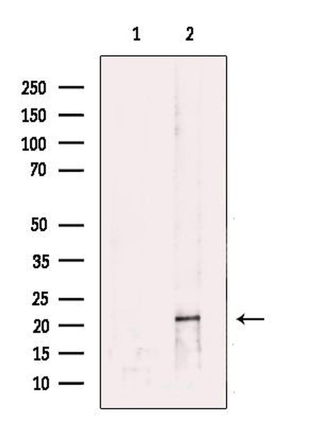 Rap1B Antibody in Western Blot (WB)