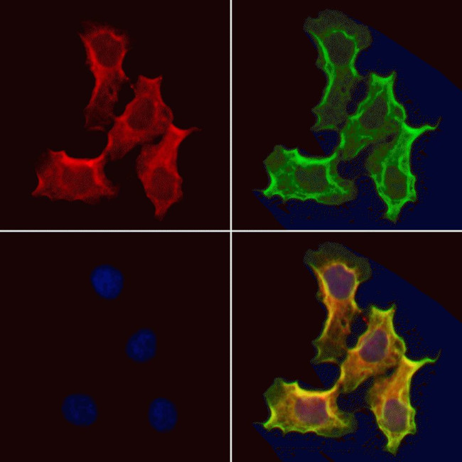 ARHE Antibody in Immunocytochemistry (ICC/IF)