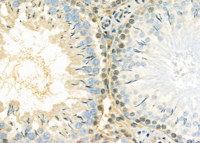 RQCD1 Antibody in Immunohistochemistry (Paraffin) (IHC (P))