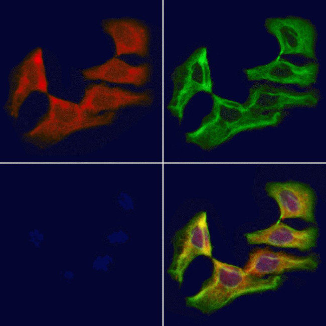 SACM1L Antibody in Immunocytochemistry (ICC/IF)