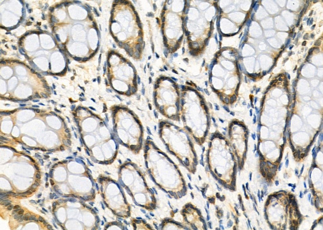 SNRPB2 Antibody in Immunohistochemistry (Paraffin) (IHC (P))
