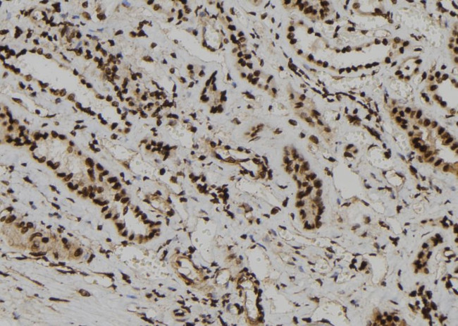 WDR46 Antibody in Immunohistochemistry (Paraffin) (IHC (P))