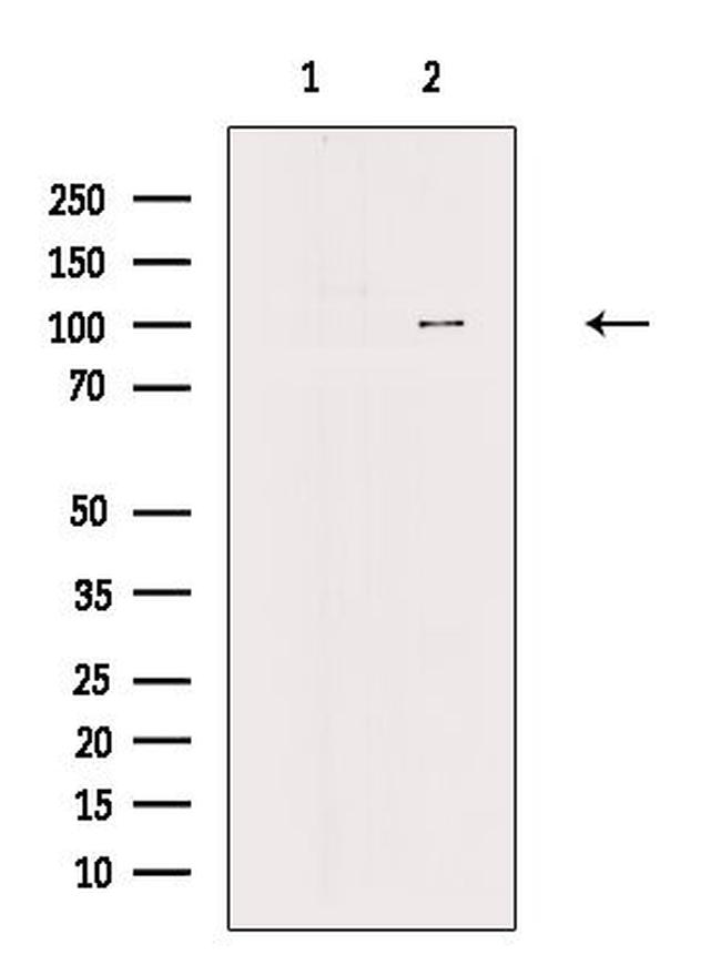 AP2A1 Antibody in Western Blot (WB)