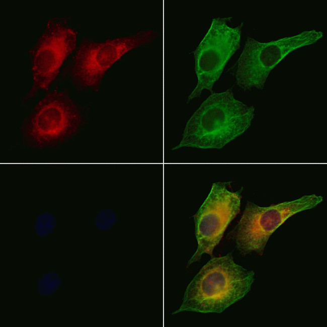 CFHR3 Antibody in Immunocytochemistry (ICC/IF)