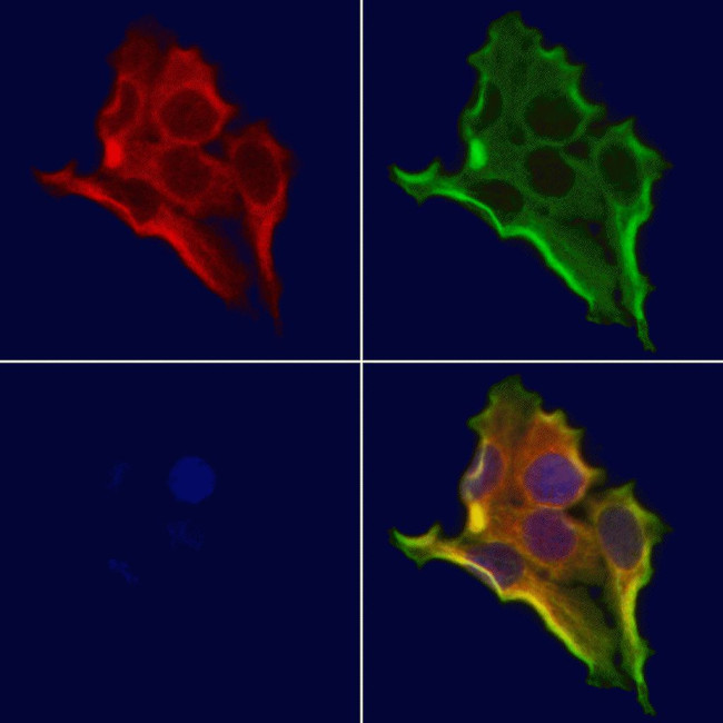 CHCHD4 Antibody in Immunocytochemistry (ICC/IF)