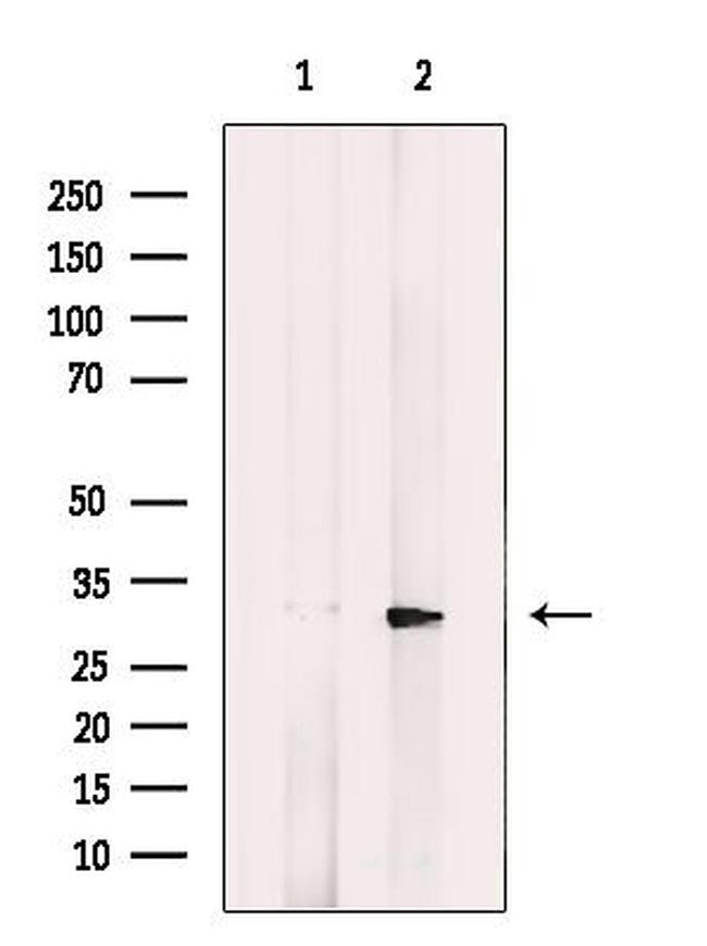 CTHRC1 Antibody in Western Blot (WB)
