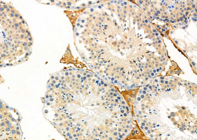 DYNC2LI1 Antibody in Immunohistochemistry (Paraffin) (IHC (P))