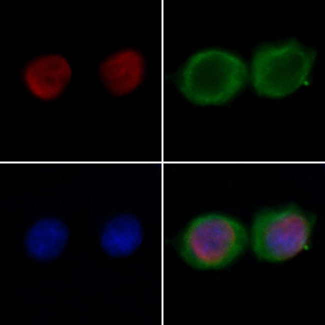 FOXO6 Antibody in Immunocytochemistry (ICC/IF)