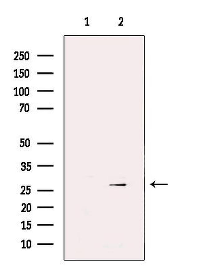 GSTM3 Antibody in Western Blot (WB)