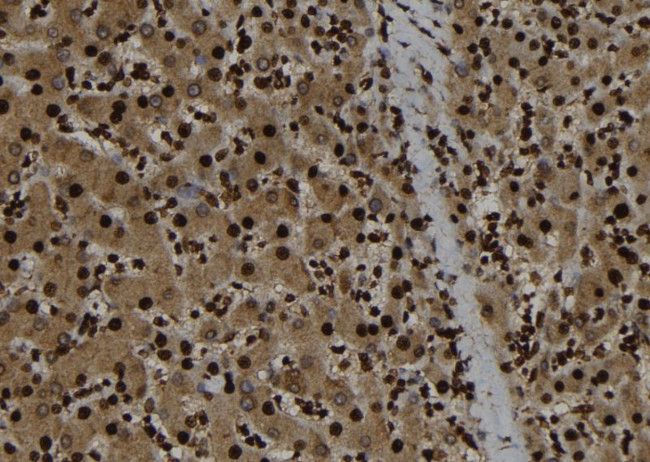 p107 Antibody in Immunohistochemistry (Paraffin) (IHC (P))