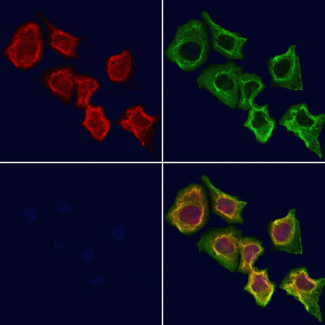 PARVB Antibody in Immunocytochemistry (ICC/IF)
