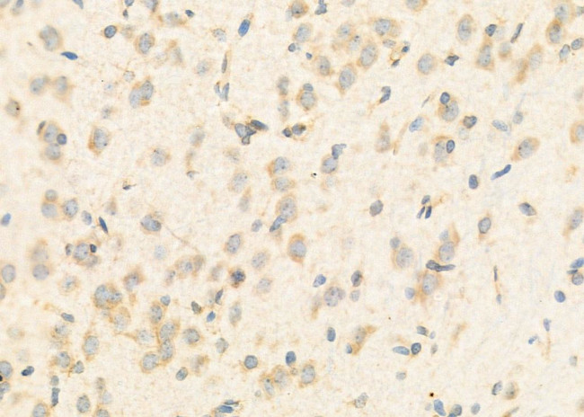 EXOC3 Antibody in Immunohistochemistry (Paraffin) (IHC (P))