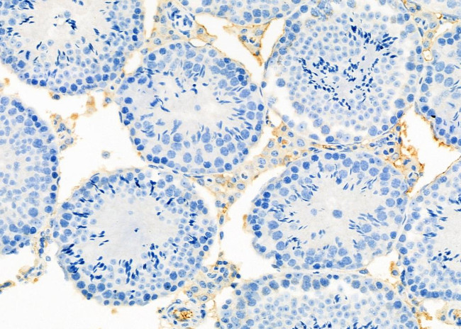 TRPC4AP Antibody in Immunohistochemistry (Paraffin) (IHC (P))