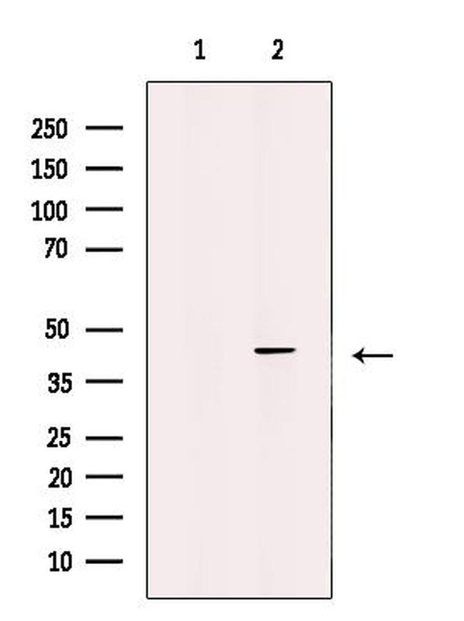WISP1 Antibody in Western Blot (WB)