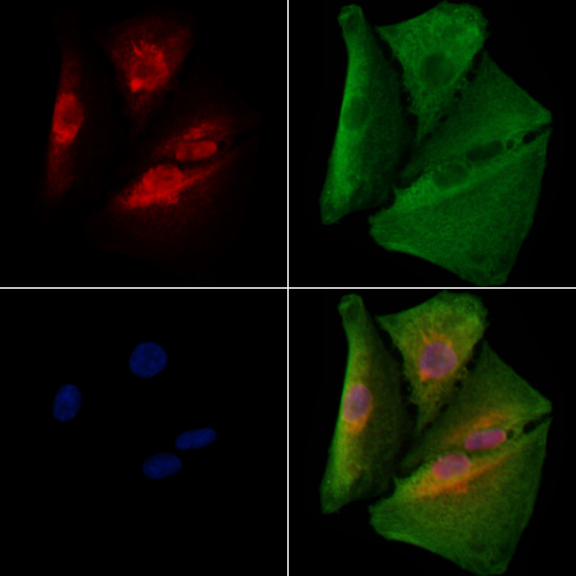 NFYC Antibody in Immunocytochemistry (ICC/IF)