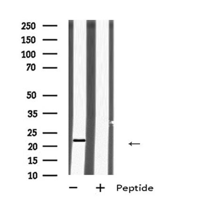 HIV1 (Virion infectivity factor) Antibody in Western Blot (WB)