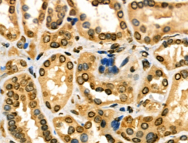 DGKI Antibody in Immunohistochemistry (Paraffin) (IHC (P))
