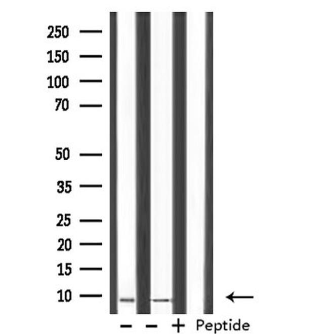 HMGN2 Antibody in Western Blot (WB)
