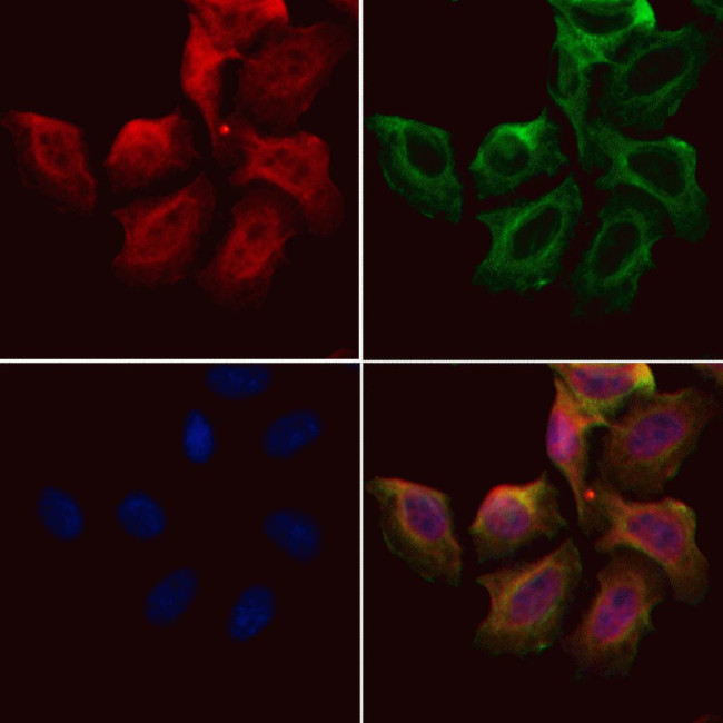 SnoN Antibody in Immunocytochemistry (ICC/IF)