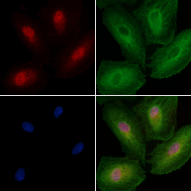 ZNF18 Antibody in Immunocytochemistry (ICC/IF)