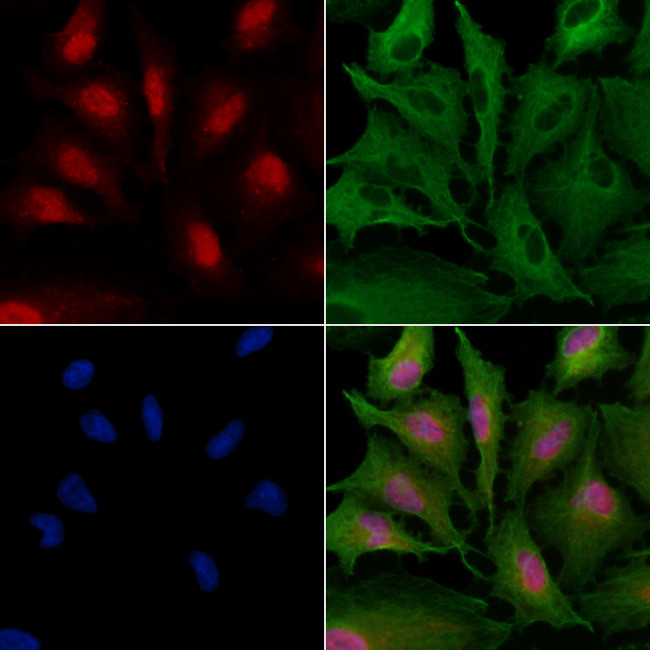 ZNF24 Antibody in Immunocytochemistry (ICC/IF)