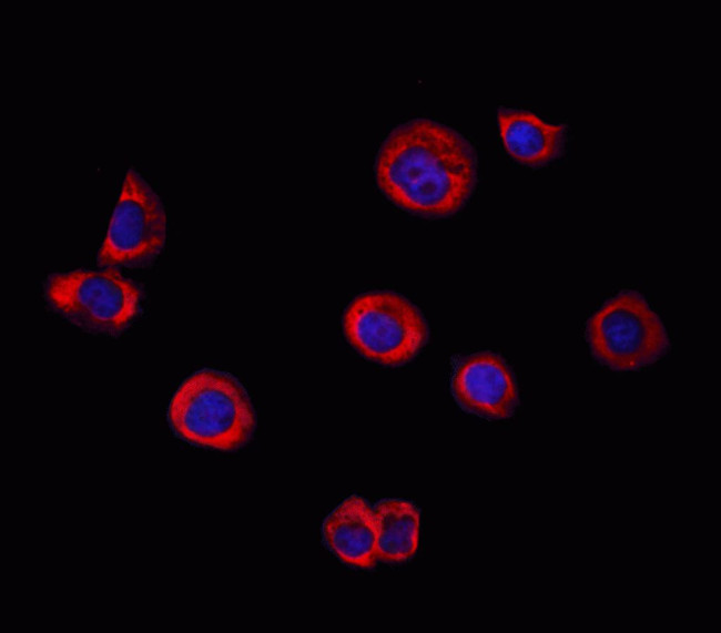 DGKA Antibody in Immunocytochemistry (ICC/IF)