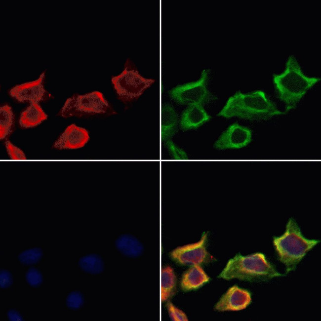 LTK Antibody in Immunocytochemistry (ICC/IF)