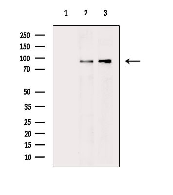 DYRK1A Antibody in Western Blot (WB)