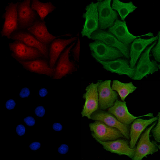 TSSC1 Antibody in Immunocytochemistry (ICC/IF)
