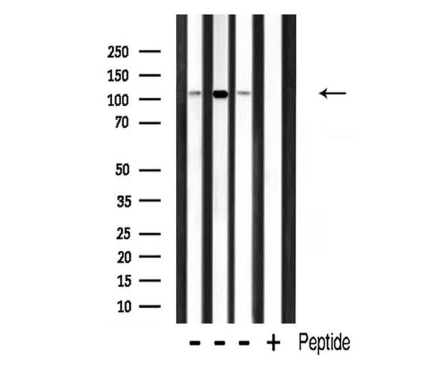 RBM26 Antibody in Western Blot (WB)