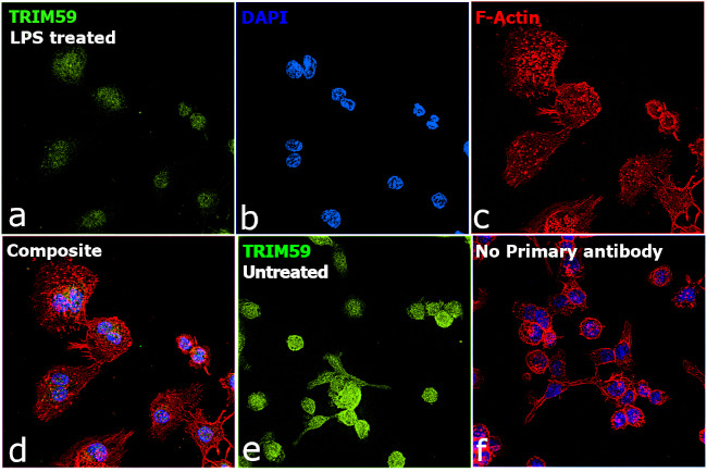 TRIM59 Antibody in Immunocytochemistry (ICC/IF)