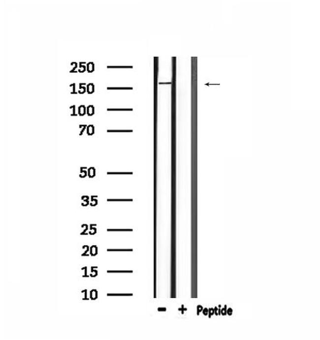 LMTK2 Antibody in Western Blot (WB)